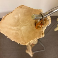 ヘルニア脊柱模型の画像