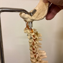 ヘルニア脊柱模型の画像