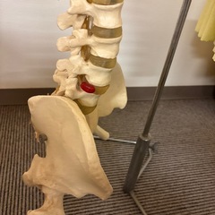 ヘルニア脊柱模型の画像