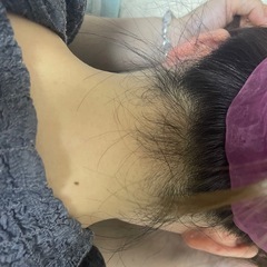 脱毛モニター様募集⭐️の画像