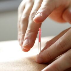 鍼灸、整体、足ツボ、カッピング選べるセミナー❗現場で即実践の技術を学びませんか✨の画像