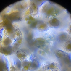 メダカの活き餌　ワムシ　針子稚魚に
　　の画像