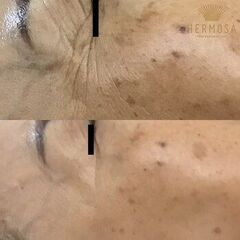 お悩み改善の費用を抑える方法
