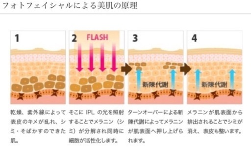 【新品未使用】導入研修有/業務用脱毛器GLEE/光フォト/光豊胸