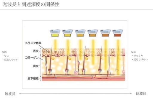 【新品未使用】導入研修有/業務用脱毛器GLEE/光フォト/光豊胸