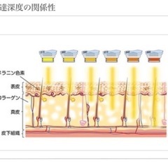 【新品未使用】業務用脱毛器GLEE/光フォト/光豊胸の画像