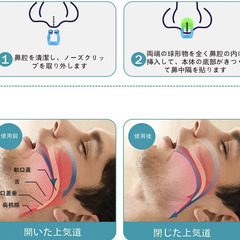 😴【新品未使用】いびき防止グッズ ノーズクリップ 6個セット 鼾防止 鼻孔拡張 睡眠補助 鼻呼吸促進 快眠グッズ 水洗い可 男女兼用 acolaruo 睡眠改善 旅行用 いびき対策の画像