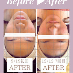 【11/12｜限定2名】Yukui.式美骨コルギ💜整形級の小顔の技を伝授🔥の画像