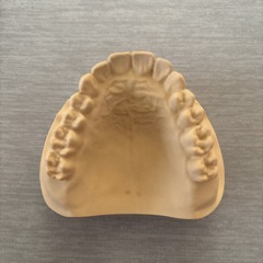 歯科　石膏模型の画像