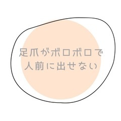 巻き爪、足のお爪でお悩みの方へ🦶