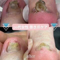 9月28日整体DAYを開催します！マッサージと爪のトラブル相談できます！ - 匝瑳市