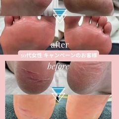 9月28日整体DAYを開催します！マッサージと爪のトラブル相談できます！ - 地域/お祭り
