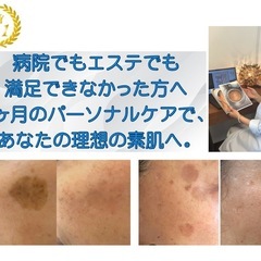 【医療✖️美容】自宅ケアで根本からパーソナルシミ改善　半年