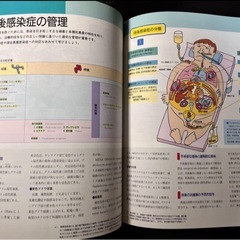 カラ－版まんがで見る 術前・術後管理ケアのポイント 術前術後看護 看護学生 オペの画像