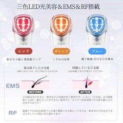 【新品】EMS 美容器 目元美顔器 多機能の画像