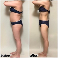 ダイエットモニター追加募集🔥この価格は今年、最後の予定です🙇‍♀️の画像