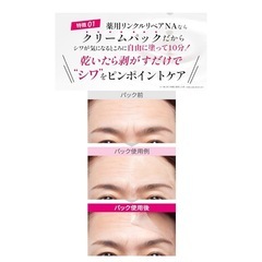 薬用 シワ改善クリームパック ほうれい線 眉間 たるみ おでこ しわ取り リンクルリペアNA30ｇの画像