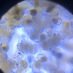 メダカの生き餌　稚魚　針子にの画像