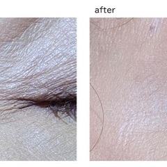 たるみ　シワ　乾燥等お肌にお悩み抱えているあなたへ