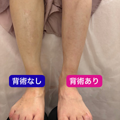 【女性限定💆‍♀️脚から全身スッキリ✨】血流改善ウェルスパ体験3,800円＋エステ割引券付きの画像