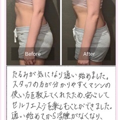 📣 最高峰 業務用エステマシン【iContour 正規品】本格ボディ痩身・フェイシャル対応✨の画像