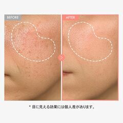 TOSOWOONG ピーチ80 ナイアシンセラムの画像