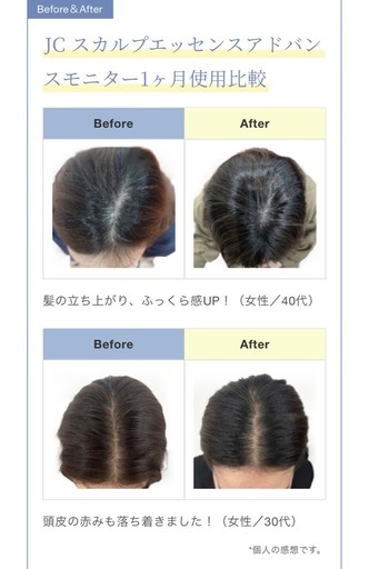jcスカルプ 育毛剤　発毛剤　頭皮用美容液