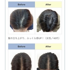 jcスカルプ 育毛剤　発毛剤　頭皮用美容液の画像