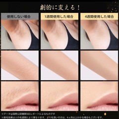 光美容器 HZCYS powerproの画像