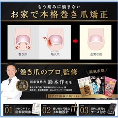 ☆未使用☆ 匠の巻き爪 矯正器具 の画像