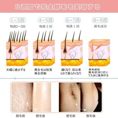 IPL光脱毛器 冷感モード付き 5段階調節可 液晶表示 全身適用 フラッシュ式 無痛 男女兼用 日本語取扱説明書の画像