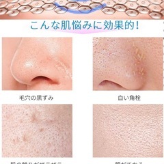 毛穴ケアに、ウォータピーリング美顔器の画像