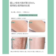  脱毛器 擦るだけ　ナノガラス脱毛器 無痛・物理脱毛 角質除去 ナノ脱毛器　の画像