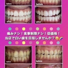 セルフホワイトニング施術 - 沖縄市