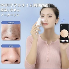 毛穴吸引器 鼻 真空吸引式【2025年新版 拡大レンズ LEDライト内蔵】　携帯で毛穴を見ながら👀✨の画像