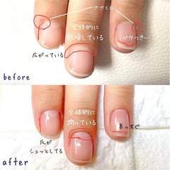 アロマネイルケア（自爪育成）の画像