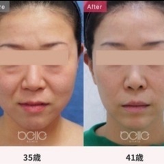 半永久❣️金の糸🪡美容外科提携サロン❣️無料カウンセリング❣️