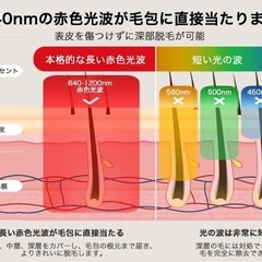 IPL光脱毛器の画像