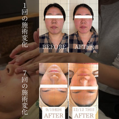 Yukui.式小顔リフト｜独自の小顔メソッドを伝授🔥の画像