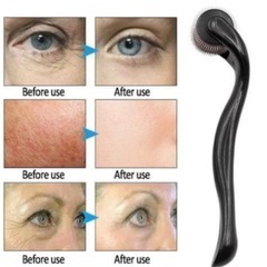 ダーマローラ未使用新品の画像