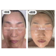 Perm式★現役エステティシャンが教える頭蓋骨小顔コルギ習得コース¥120,000の画像