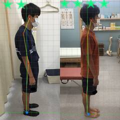 【長野市・須坂市】骨盤の歪みを整えて姿勢スッキリ！初回体験あり｜...