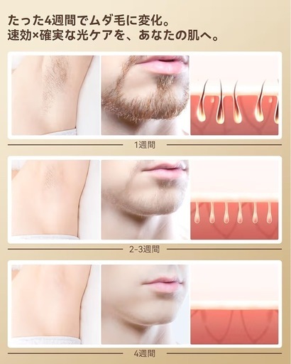 【破格】新品★サロン級 YUNDOO 脱毛器 VIO/全身対応 10000円→7500円