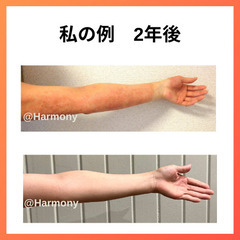 たった3ヶ月でガサガサー肌→別人級うるツヤ肌になった秘策を…