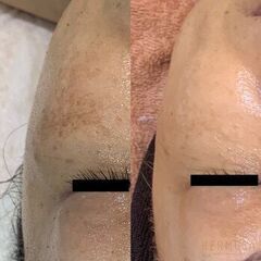 ホームケアが結果を左右する！大人の肌が求めるバリア