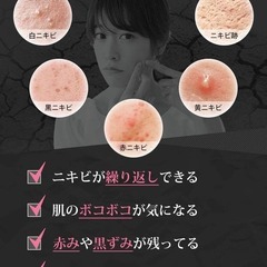 ニキビ ニキビ跡 ケア クリーム 化粧水 2点セット 薬用 アクノ【医師監修】の画像