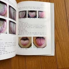 舌診論の画像