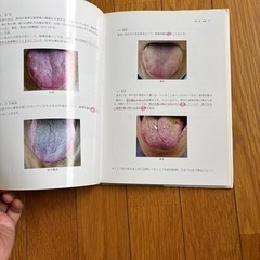 舌診論の画像
