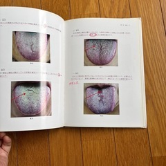 舌診論の画像