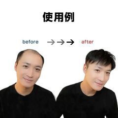 ウィッグ メンズ 男性 ヘアピース 人毛100％ 頭頂部 部分ウィッグ トップカバー 薄毛 白髪隠し 増毛 ボリュームアップ 自然 簡単装着 通気性 かつら 黒 ブラックの画像